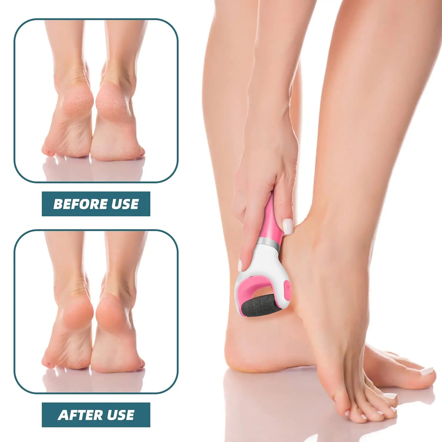 Electric Foot Callus Remover