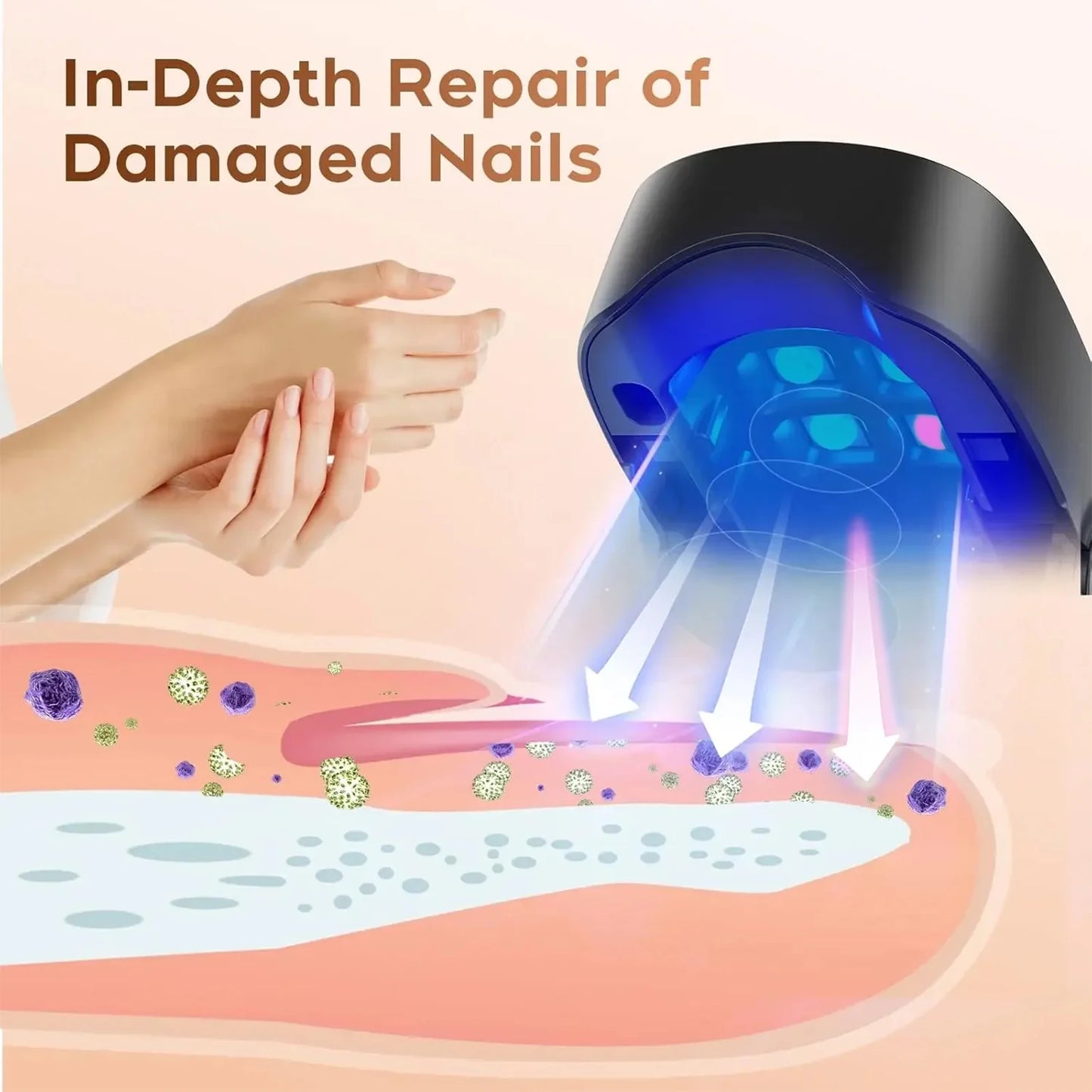 Nail Fungus Treatment Device