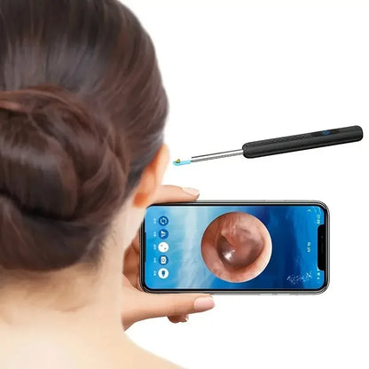 Smart Visual Ear Cleaner