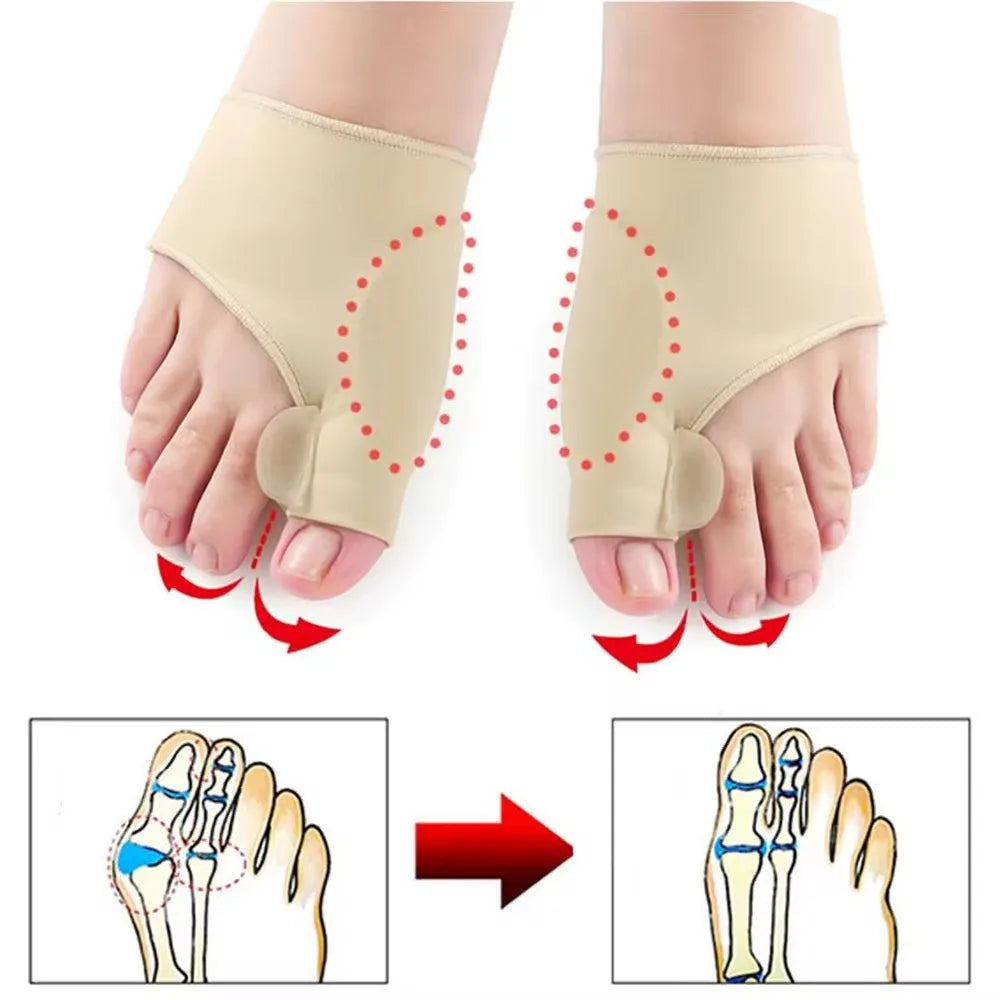 Toe Straightener Bunion Corrector