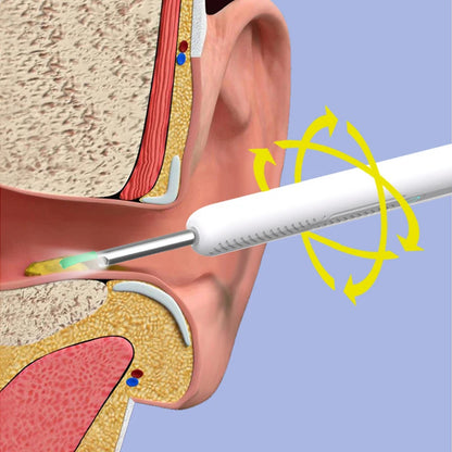 Smart Visual Ear Cleaner with Camera