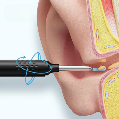 Smart Visual Ear Cleaner