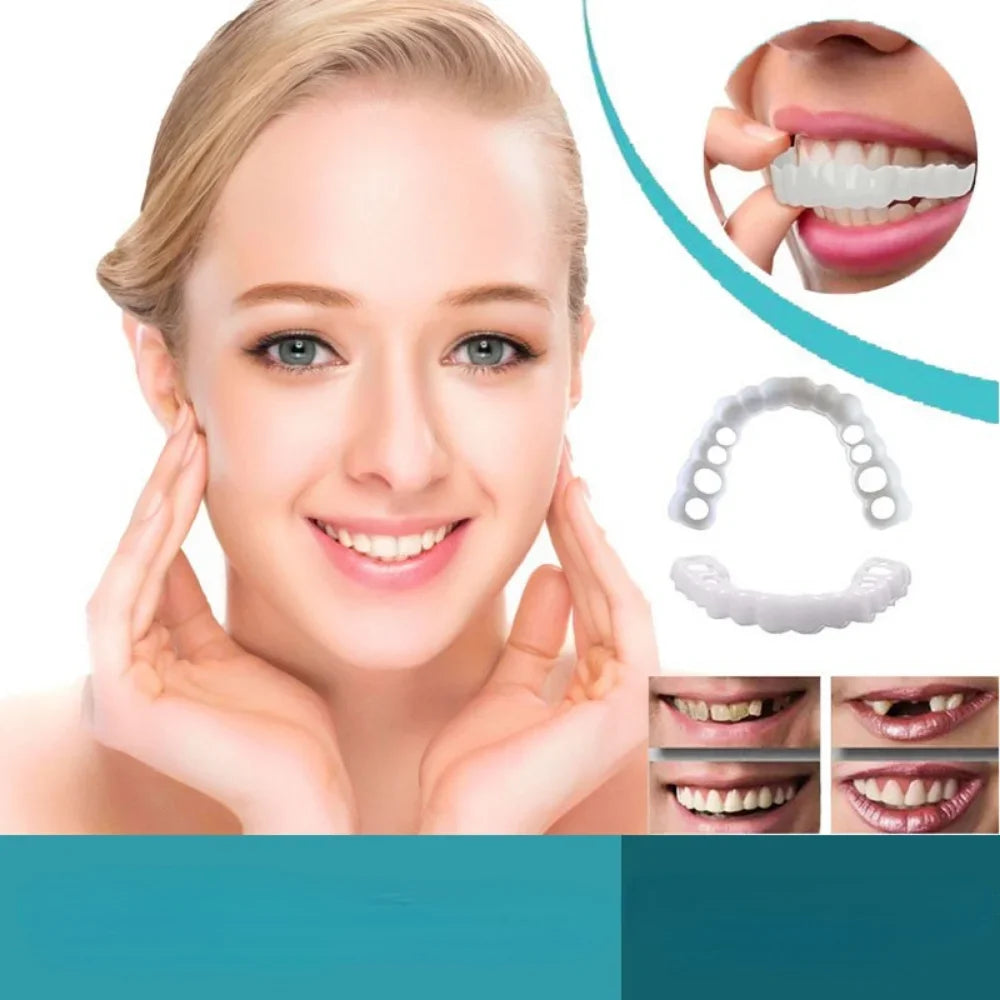 Snap On Smile Veneers