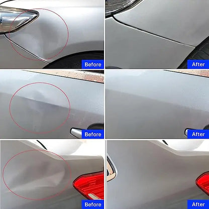 Paintless Dent Repair Kit