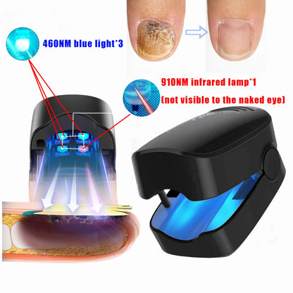 Nail Fungus Treatment Device