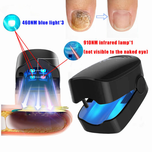 Nail Fungus Treatment Device