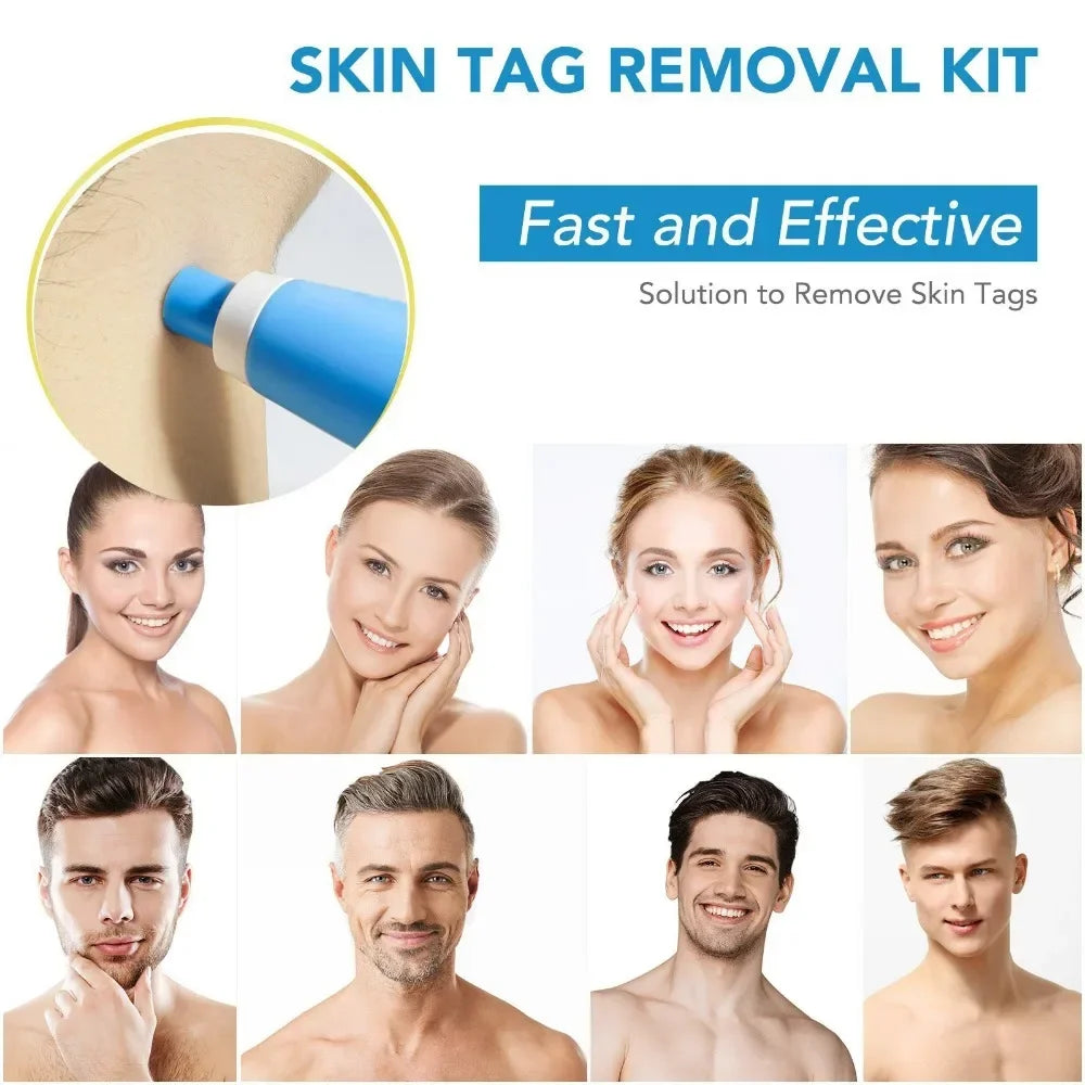 Painless Skin Tag Remover Pen