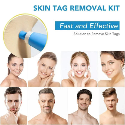Painless Skin Tag Remover Pen